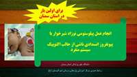 انجام جراحی پیلوستومی در نوزاد شیرخوار ۶۰ روزه برای اولین بار در دانشگاه علوم پزشکی استان سمنان