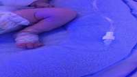 انجام پروسیجر های PICC در بخش NICU مرکز آموزشی درمانی پزوهشی امیرالمومنین (ع)
